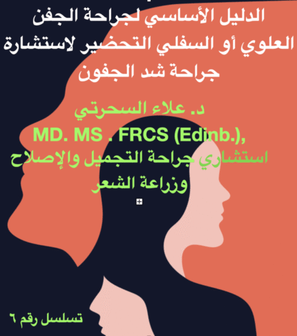 جراحة الجفن العلوي أو السفلي (رأب الجفن)