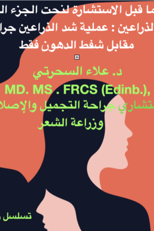 تشريح الذراع العلوي وتحديد شكله، شرح عملية شد الذراع